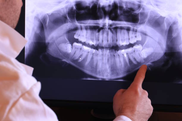 Best Emergency Treatment for Oral Infections in Fruitville, FL